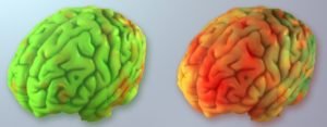 Lamotrigine et cerveau